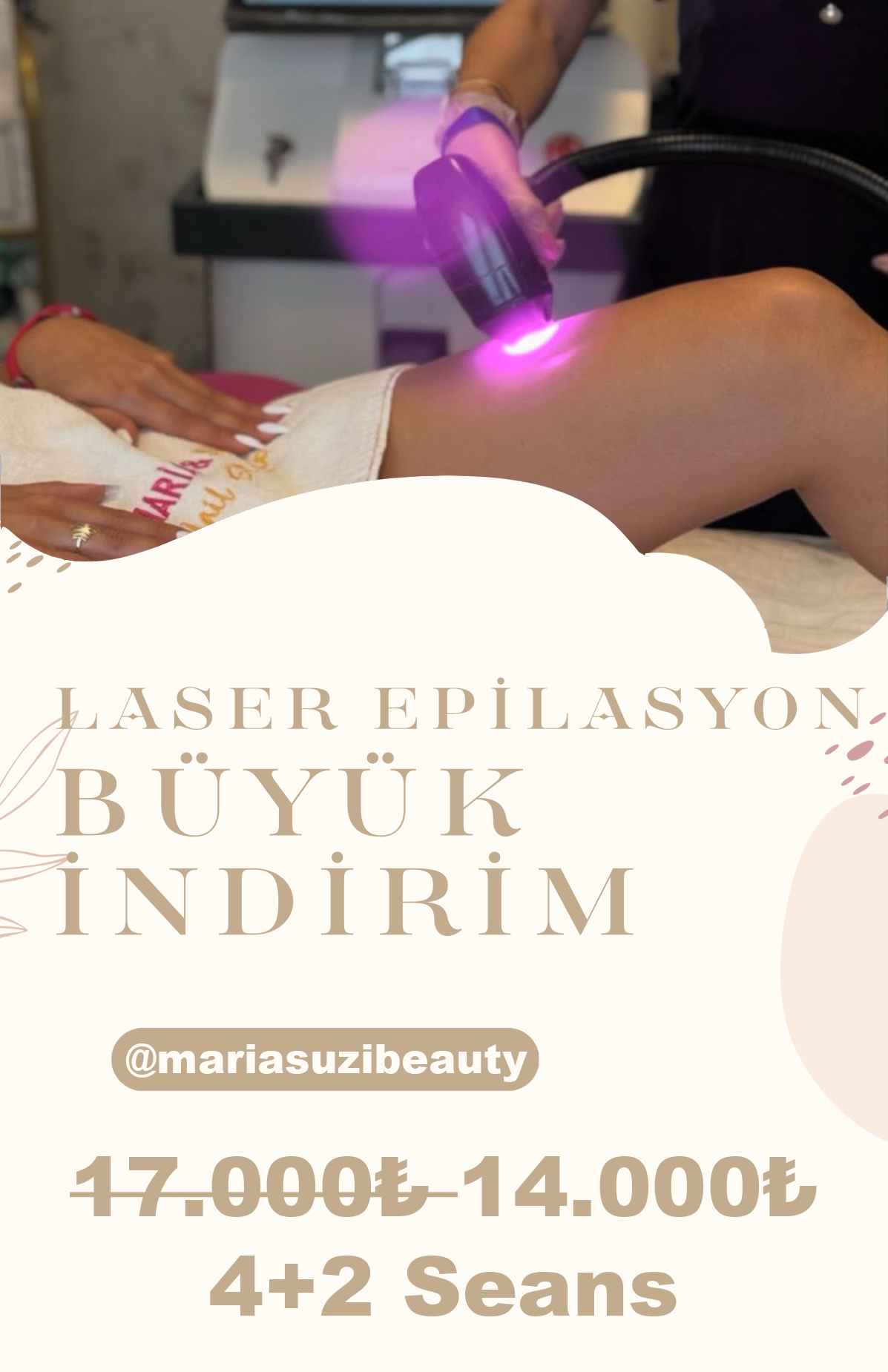 Lazer Epilasyon Kampanya Başladı